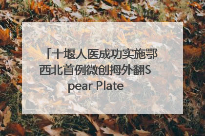 十堰人医成功实施鄂西北首例微创拇外翻Spear Plate髓内板矫形术